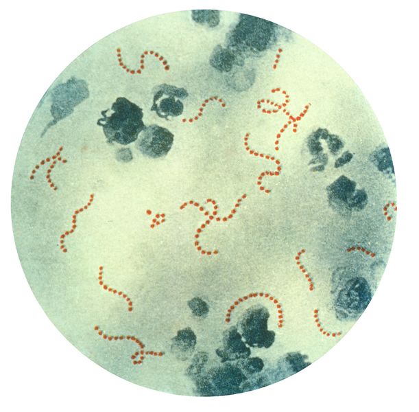 File:Streptococcus pyogenes 01.jpg